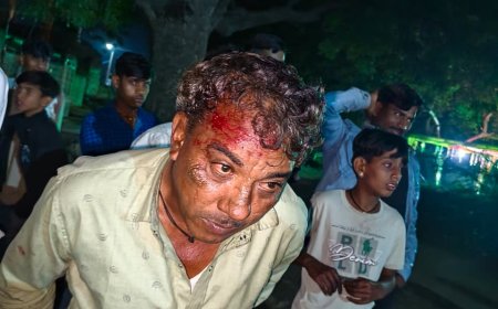 बंदर का आतंक, 8 से 10 लोगो को।किया  घायल, ग्रामीण परेशान